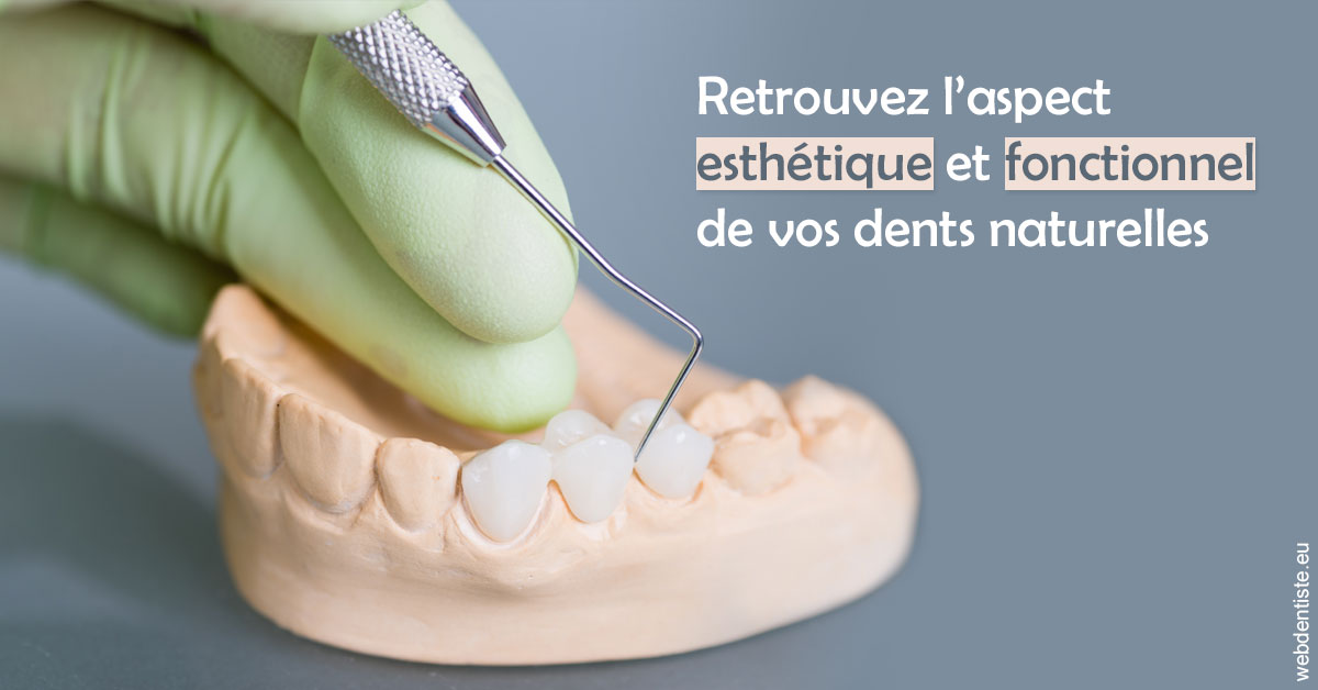 https://dr-jean-luc-vouillot.chirurgiens-dentistes.fr/Restaurations dentaires 1