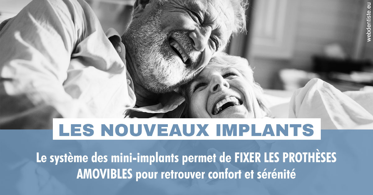 https://dr-jean-luc-vouillot.chirurgiens-dentistes.fr/Les nouveaux implants 2