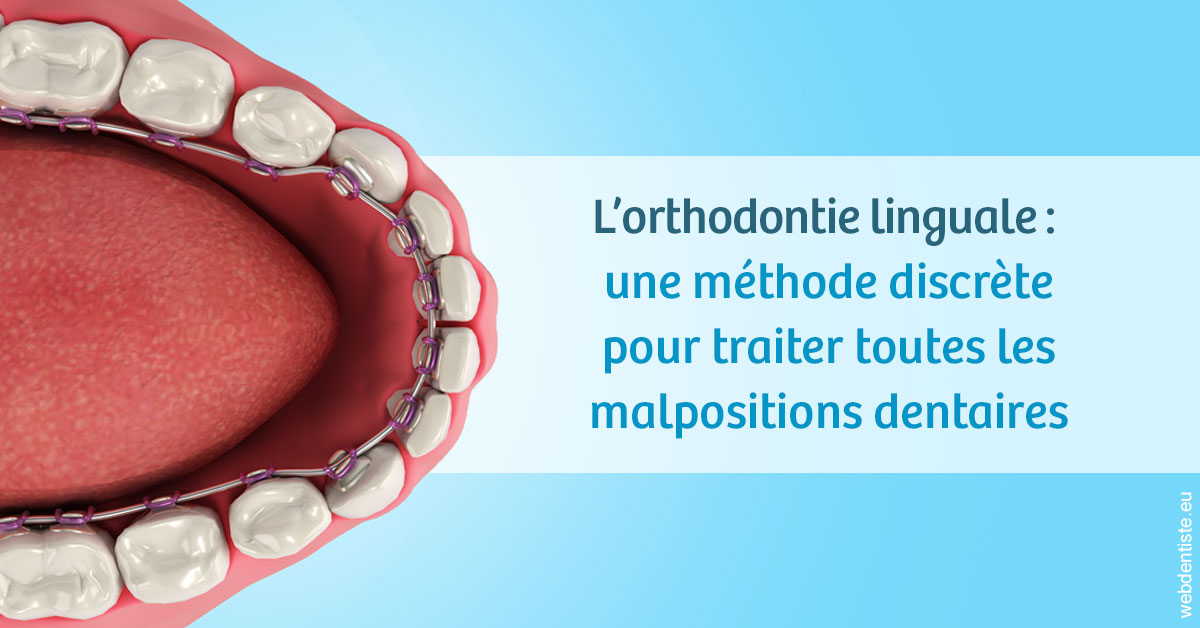 https://dr-jean-luc-vouillot.chirurgiens-dentistes.fr/L'orthodontie linguale 1