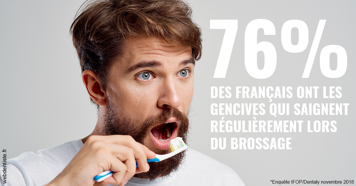 https://dr-jean-luc-vouillot.chirurgiens-dentistes.fr/76% des Français 2