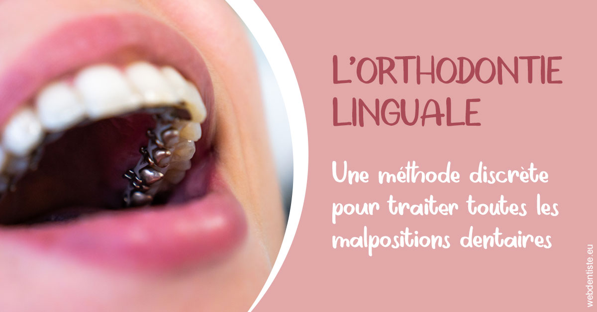 https://dr-jean-luc-vouillot.chirurgiens-dentistes.fr/L'orthodontie linguale 2
