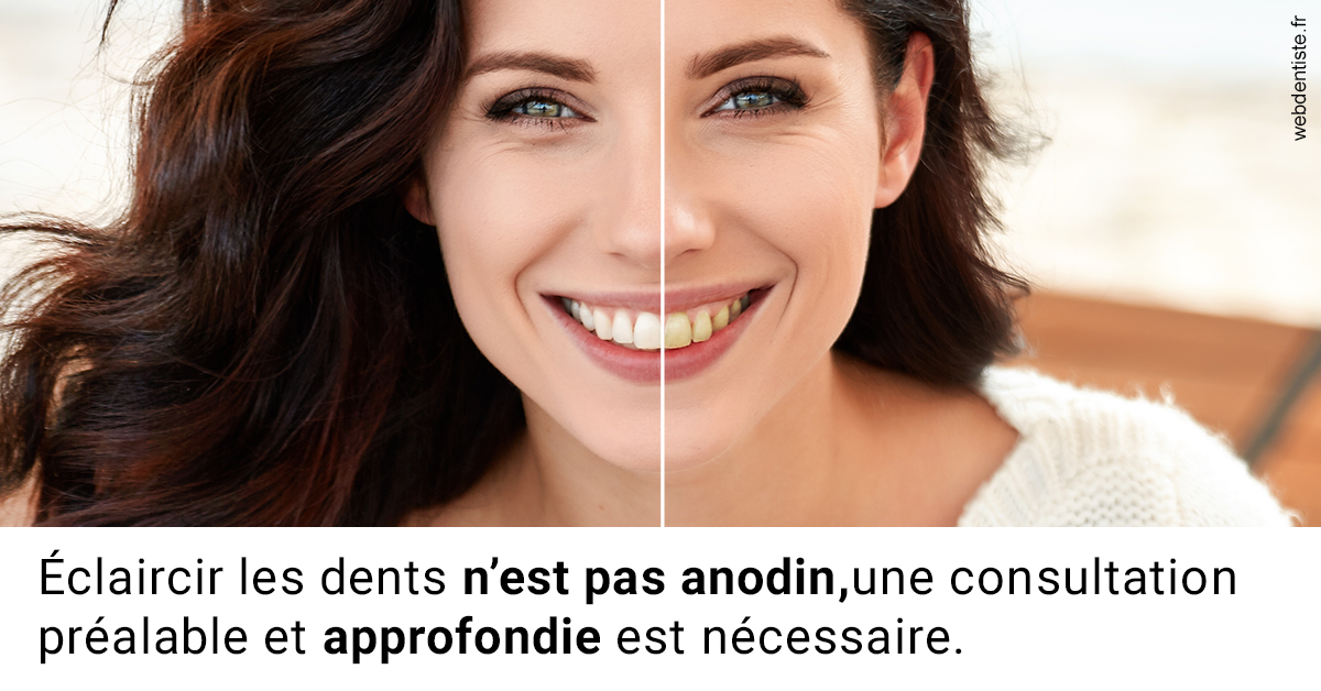 https://dr-jean-luc-vouillot.chirurgiens-dentistes.fr/Le blanchiment 2