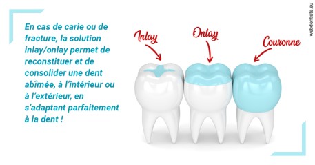 https://dr-jean-luc-vouillot.chirurgiens-dentistes.fr/L'INLAY ou l'ONLAY