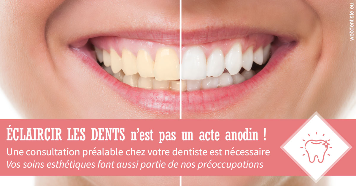 https://dr-jean-luc-vouillot.chirurgiens-dentistes.fr/Eclaircir les dents 1
