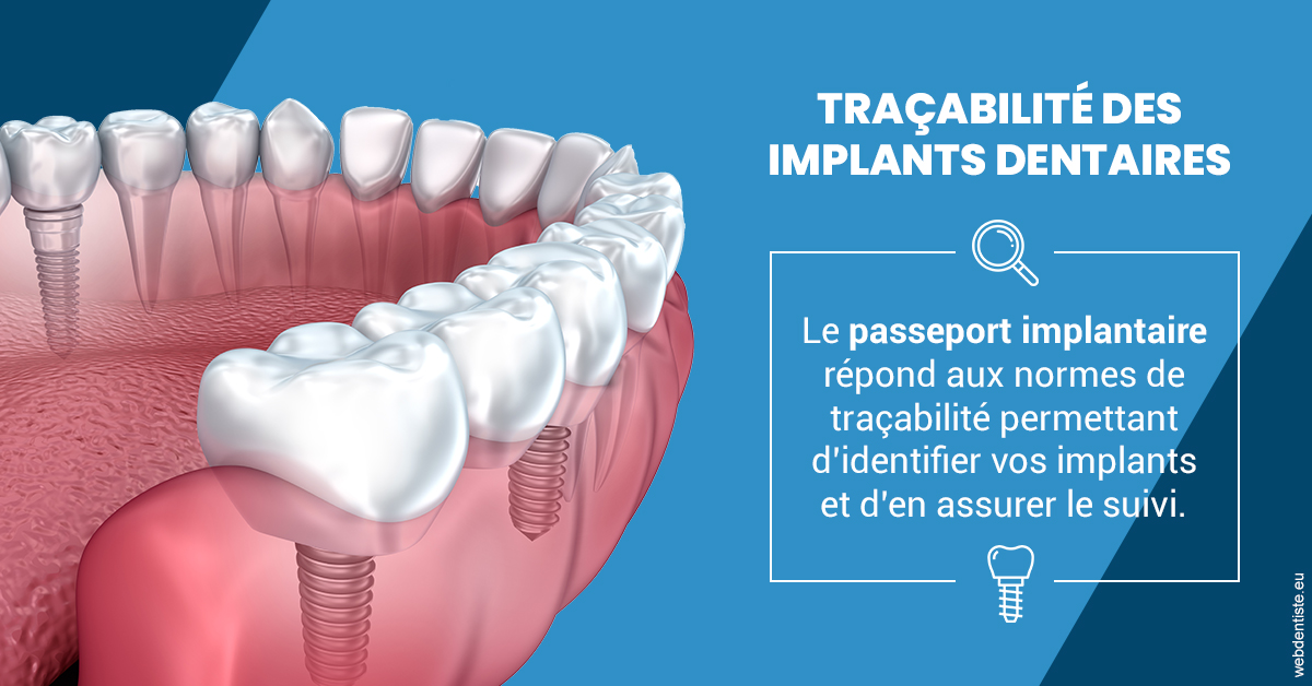 https://dr-jean-luc-vouillot.chirurgiens-dentistes.fr/T2 2023 - Traçabilité des implants 1