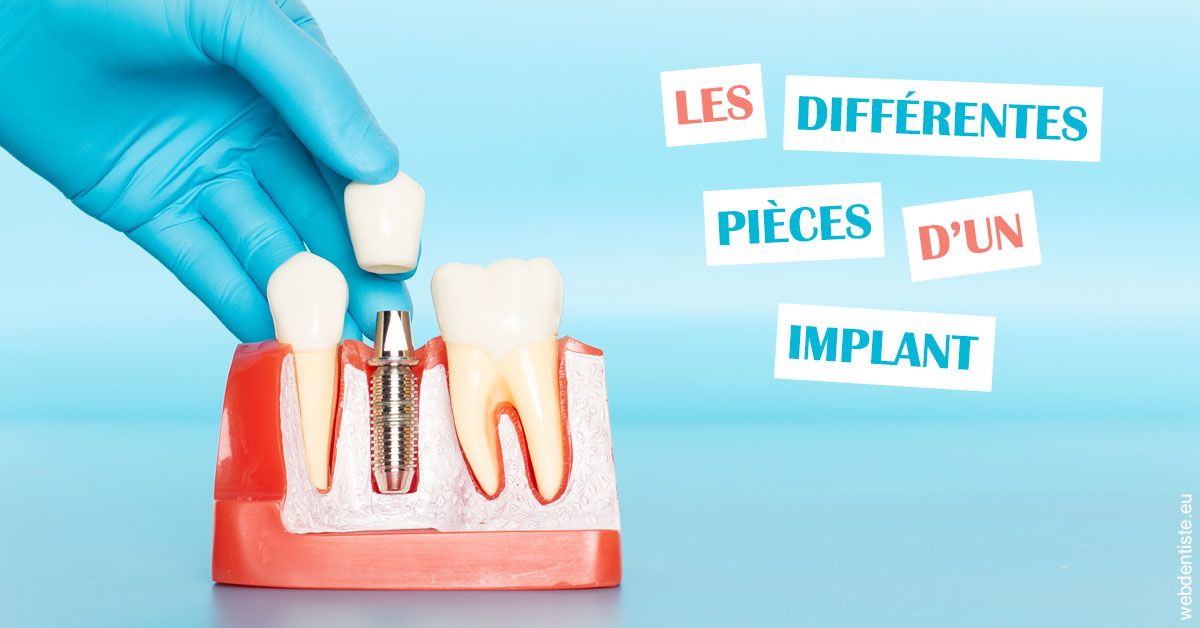 https://dr-jean-luc-vouillot.chirurgiens-dentistes.fr/Les différentes pièces d’un implant 2