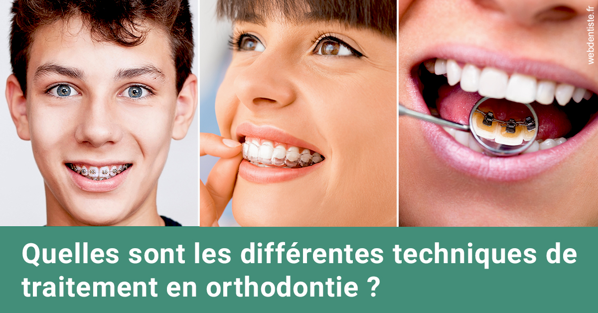 https://dr-jean-luc-vouillot.chirurgiens-dentistes.fr/Les différentes techniques de traitement 2