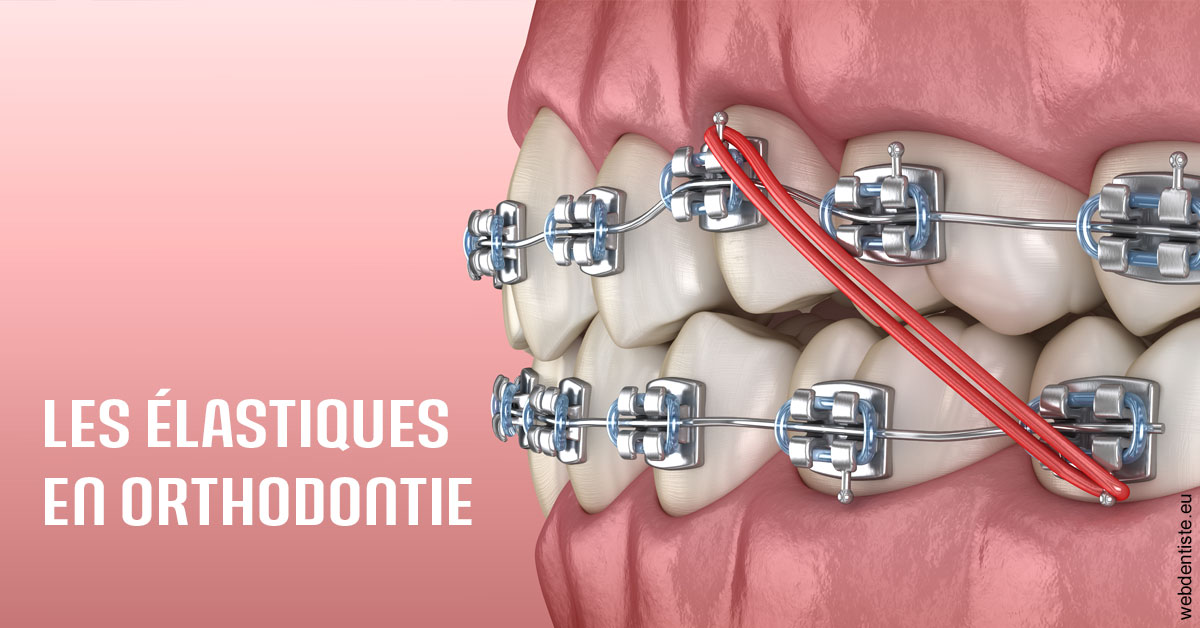 https://dr-jean-luc-vouillot.chirurgiens-dentistes.fr/Elastiques orthodontie 2
