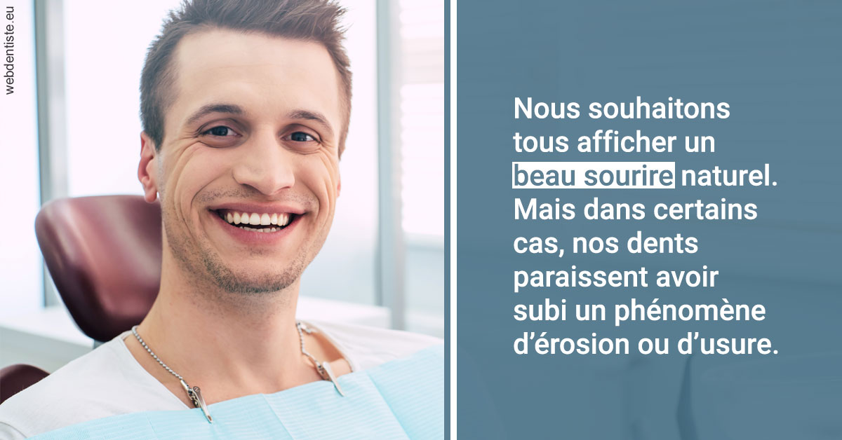 https://dr-jean-luc-vouillot.chirurgiens-dentistes.fr/Érosion et usure dentaire