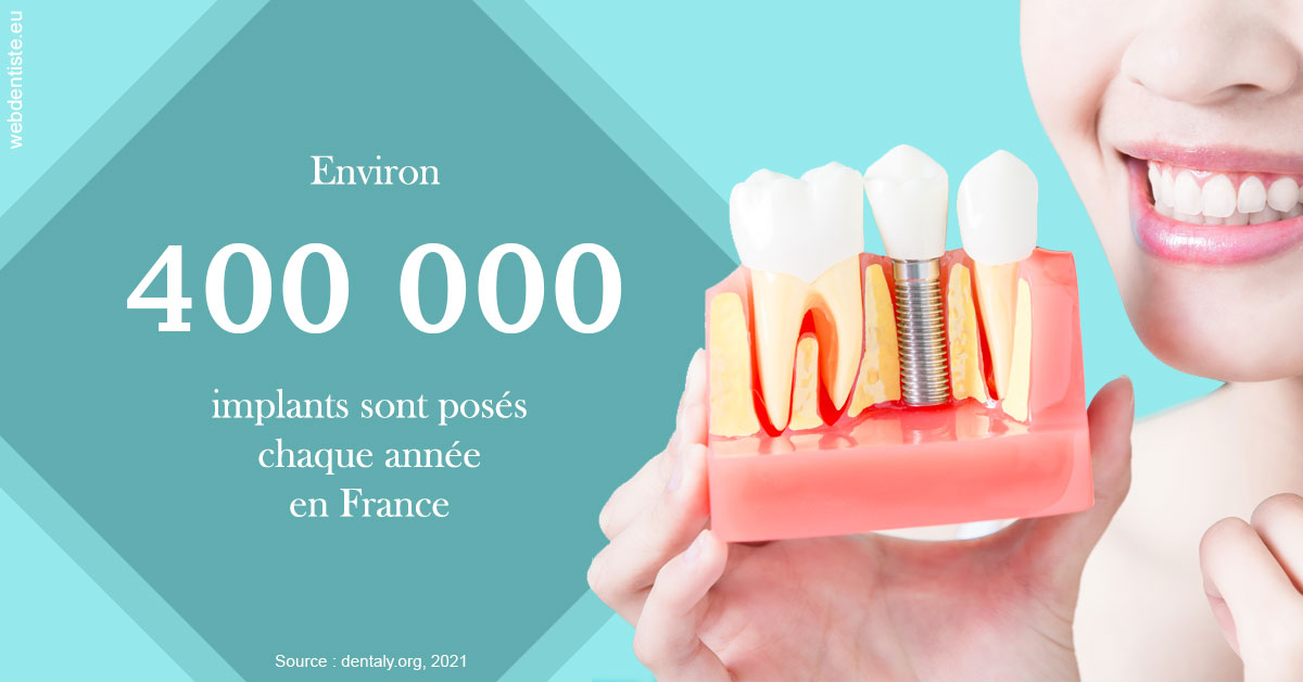 https://dr-jean-luc-vouillot.chirurgiens-dentistes.fr/Pose d'implants en France 2